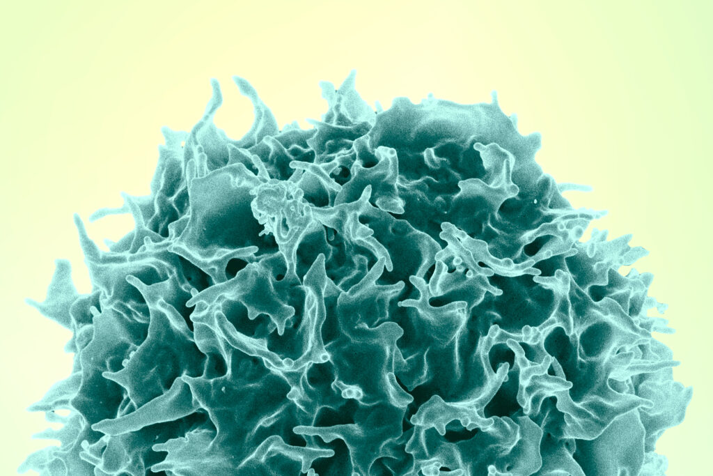 Colorized scanning electron micrograph of a T cell